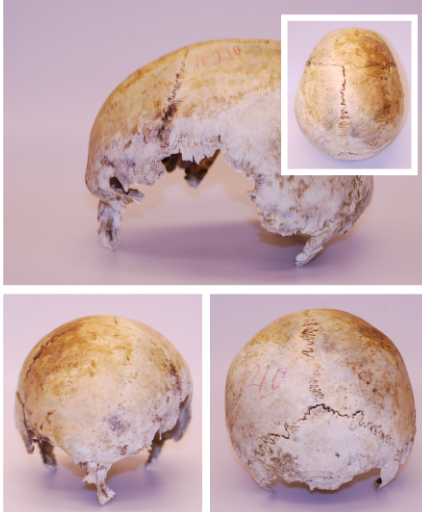 Human Remains Discovered in 1975 Identified as Claude Hamilton Brownscombe